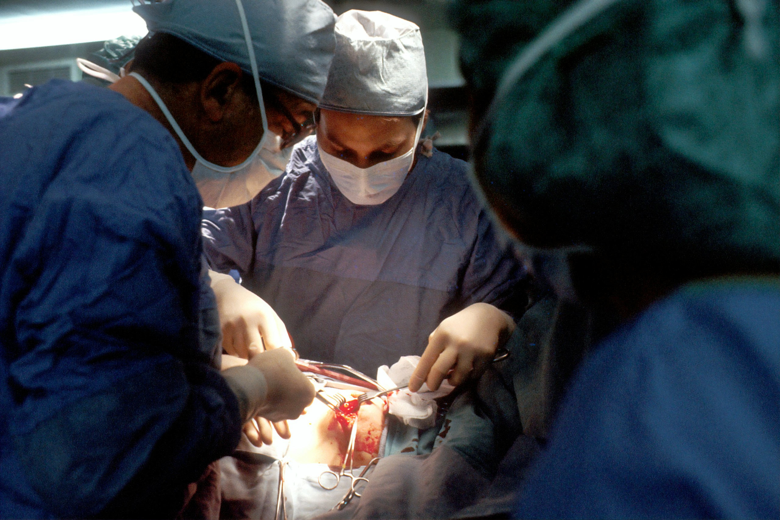 Biopsy. A Caucasian woman patient is being operated on. Her nipple is being incised by the surgeon. The male surgeon and an operating room attendant are visible. A surgical biopsy is being performed to determine exact nature of solid tumor. Creator: Linda Bartlett